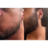 کلینیک تخصصی درمان ریزش و رویش مو