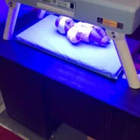 دستگاه زردی نوزاد در گنبد کاووس