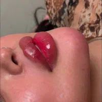 زاویه سازی*فرم دهی*زیبایی