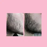 محصول رویش و پرپشتی ریش سیبیل