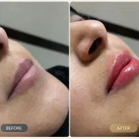 مدل (برای مدت محدود )
