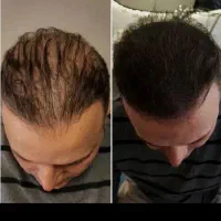دیگه نبینم پول کاشت بدی