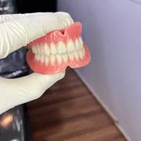 دندانسازی مصیبی تحویل یکروزه تضمینی