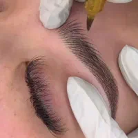 میکروبلیدینگ سبک فیبروز
