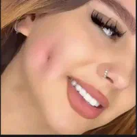 پیرسینگ میکرودرمال چال لپ با بخیه پلاسما