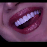 زیر قیمت بیمه،خدمات دندانپزشکی ۵۰٪ تخفیف حقیقی|خدمات زیبایی و سلامت|تهران, جمال‌زاده|دیوار