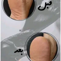 کفشابی و ناخن کاشت ۳۸۰ تومانی