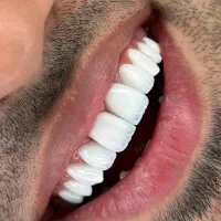 خدمات تخصصی دندانپزشکی زیبایی و لمینیت جماران