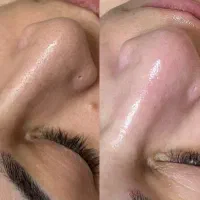 پاکسازی پوست