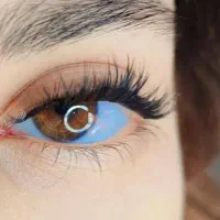 اف ویژه کاشت مژه