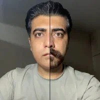 رویش ریش با روش تخصصی