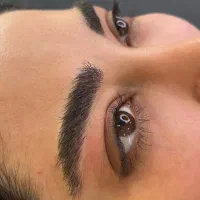 میکروبلیدینگ فیبروز ابرو شیدلب