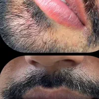 رفع کبودی و تیرگی لب برای آقایون