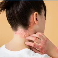 هر که بامش بیش برفش بیشتر