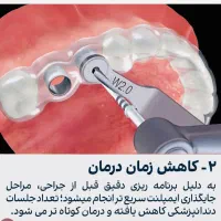 مرکزفوق تخصصی ایمپلنت دیجیتال/بدون درد/روکش فوری
