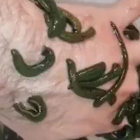 پرورش و پخش زالوی طبی
