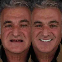 دندانپزشکی تعرفه دولتی باغشاد