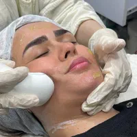 تخفیف ویژه فیشیال تخصصی کاربادستگاه ها ومزوولیفت