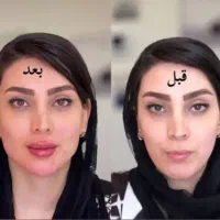 دنبی ،درموفیل ،رئوفیل