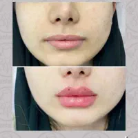 درخواست اجاره صندلی