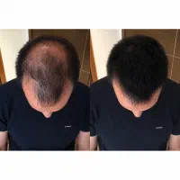 راز موهای پرپشت و خوشحالت