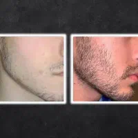 سی بیل|آرایشی، بهداشتی، درمانی|نیر (اردبیل), |دیوار