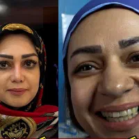 یه بینی خوشگل هایپر نچرال منتظرته