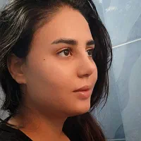 عمل بینی در تهران/برای شهروندان اندیمشک/۴۳میلیون