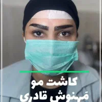 قیمت ها شکسته شد، کاشت مو و ابرو در اهواز
