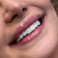خدمات درمانی دندانپزشکی تبسم شیرین