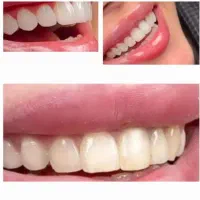 آموزش کامل  دندانپزشکی . .بصورت اقساطی