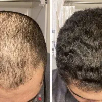 وقتشه موهات جون بگیرن
