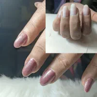 کاشت ناخن