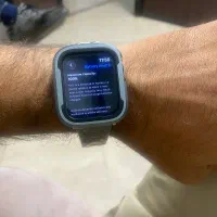 اپل واچ se سری ۱۰ سایز ۴۴