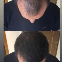 راه حلش دست منه