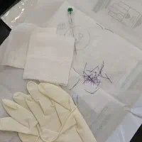 کاهش وزن و سایز با کاشت نخ لاغری( امبدینگ)