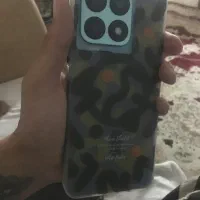 گوشی سالم سالم درحد آک هانر x8a