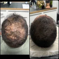 کلت میشه جنگل آمازون