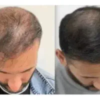 از تغییر تا تاثیر