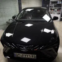 مجموعه تخصصی رفع آفتاب سوختگی،نانو سرامیک،کاوربدنه