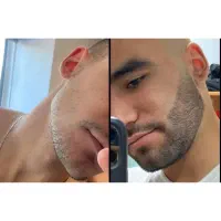حجم ریشاتو ۳ برابر کن