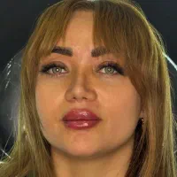ژل،بوتاکس،نخ،مزوتراپی،prpتوسط پزشک با قیمت عالی