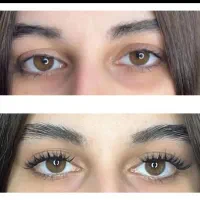 کاشت ناخن، کاشت مژه هیدن، اپلاسیون، اصلاح صورت