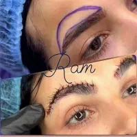 جراحی های زیبایی لیفت شقیقه ابرو صورت غبغب پلک