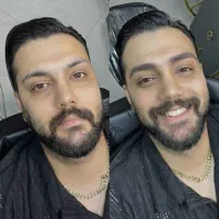 میکروبلیدینگ ابرو فوق طبیعی، رفع تیرگی لب اقایان