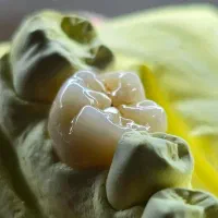 تدریس و آموزش خصوصی دندانسازی