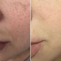 کرم های بیوممتیک تضمینی / بدون بازگشت