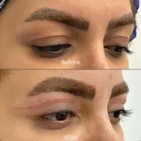 بوتاکس ژل ساکشن چربی جراحی بینی در کلینیک بهنود|خدمات آرایشگری و زیبایی|تبریز, |دیوار