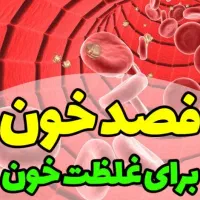 * فصد خون کیسه ای و حجامت بهداشتی*