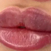 خدمات  زیبایی. ژل لب.پرسینگ.بوتاکس.لیفت ابرو